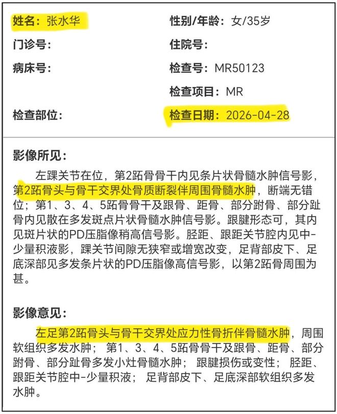 雷霆后卫托皮奇接受腰椎手术
